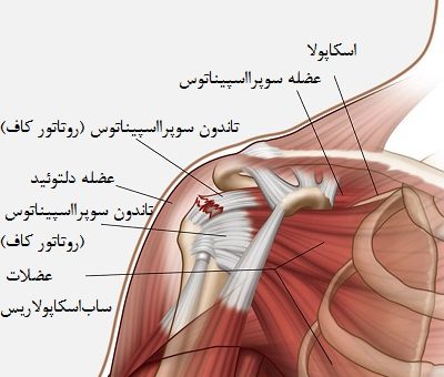 پارگی تاندون شانه 9